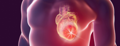Alpine Cardiology Heart Attack