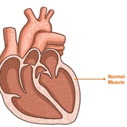 Healthy Heart
